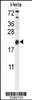 Western blot analysis in Hela cell line lysates (35ug/lane) .