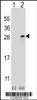 Western blot analysis of FGF9 using rabbit polyclonal FGF9 Antibody using 293 cell lysates (2 ug/lane) either nontransfected (Lane 1) or transiently transfected (Lane 2) with the FGF9 gene.