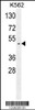 Western blot analysis in K562 cell line lysates (35ug/lane) .