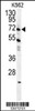 Western blot analysis in K562 cell line lysates (35ug/lane) .