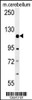 Western blot analysis in mouse cerebellum tissue lysates (15ug/lane) .This demonstrates the detected RADIL protein (arrow) .