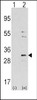 Western blot analysis of NNMT using rabbit polyclonal NNMT Antibody using 293 cell lysates (2 ug/lane) either nontransfected (Lane 1) or transiently transfected with the NNMT gene (Lane 2) .