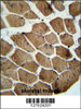 MOCS1 antibody immunohistochemistry analysis in formalin fixed and paraffin embedded human skeletal muscle followed by peroxidase conjugation of the secondary antibody and DAB staining.