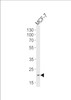 Western blot analysis of lysate from MCF-7 cell line, using NOS1AP Antibody at 1:1000 at each lane.