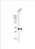 Western blot analysis of lysate from HeLa cell line, using RPS6 Antibody (Ser240/244) at 1:1000 at each lane.