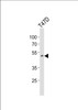 Western blot analysis of lysate from T47D cell line, using HOXA10 Antibody at 1:1000.