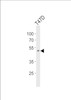 Western blot analysis of lysate from T47D cell line, using HOXA10 Antibody at 1:1000.