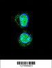 Confocal immunofluorescent analysis of HOXA10 Antibody with HepG2 cell followed by Alexa Fluor 488-conjugated goat anti-rabbit lgG (green) . DAPI was used to stain the cell nuclear (blue) .