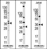 Western blot analysis of anti-HIF1AN Pab in 293, HL60 and Jurkat cell line lysates