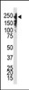 Antibody is used in Western blot to detect Dnmt1 in Jurkat cell lysate.