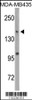 Western blot analysis of DNMT1 Antibody (S1105) in MDA-MB435 cell line lysates (35ug/lane)