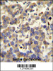 LYPD4 antibody immunohistochemistry analysis in formalin fixed and paraffin embedded human testis carcinoma followed by peroxidase conjugation of the secondary antibody and DAB staining.