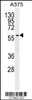 Western blot analysis in A375 cell line lysates (35ug/lane) .