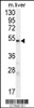 Western blot analysis in mouse liver tissue lysates (35ug/lane) .