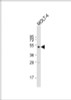 Western Blot at 1:500 dilution + MOLT-4 whole cell lysate Lysates/proteins at 20 ug per lane.