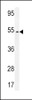 Western blot analysis in CEM cell line lysates (35ug/lane) .