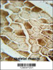 SAR1B antibody immunohistochemistry analysis in formalin fixed and paraffin embedded human skeletal muscle followed by peroxidase conjugation of the secondary antibody and DAB staining.