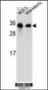 Western blot analysis in MCF-7, MDA-MB453 cell line lysates (35ug/lane) .