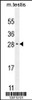 Western blot analysis in mouse testis tissue lysates (35ug/lane) .