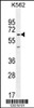 Western blot analysis in K562 cell line lysates (35ug/lane) .