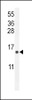 Western blot analysis in U251 cell line lysates (35ug/lane) .This demonstrates tdetected the EKI2 protein (arrow) .