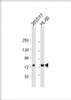 Western Blot at 1:2000 dilution Lane 1: 293T/17 whole cell lysate Lane 2: HL-60 whole cell lysate Lysates/proteins at 20 ug per lane.