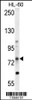 Western blot analysis in HL-60 cell line lysates (35ug/lane) .