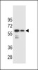 Western blot analysis in mouse spleen and lung tissue lysates (35ug/lane) .