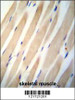 CHST3 antibodyimmunohistochemistry analysis in formalin fixed and paraffin embedded human skeletal muscle followed by peroxidase conjugation of the secondary antibody and DAB staining. This data demonstrates the use of the CHST3 antibodyfor immunohistochemistry.