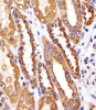 Immunohistochemical analysis of paraffin-embedded H. kidney section using CTSA Antibody (N-term) . Antibody was diluted at 1:25 dilution. A undiluted biotinylated goat polyvalent antibody was used as the secondary, followed by DAB staining.