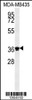 Western blot analysis in MDA-MB435 cell line lysates (35ug/lane) .