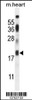 Western blot analysis in mouse heart tissue lysates (35ug/lane) .