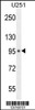 Western blot analysis in U251 cell line lysates (35ug/lane) .