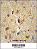 VITRN antibody immunohistochemistry analysis in formalin fixed and paraffin embedded human brain tissue followed by peroxidase conjugation of the secondary antibody and DAB staining.