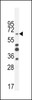 Western blot analysis in MDA-MB435 cell line lysates (35ug/lane) .