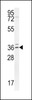 Western blot analysis in Jurkat cell line lysates (35ug/lane) .