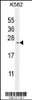 Western blot analysis in K562 cell line lysates (35ug/lane) .