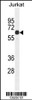 Western blot analysis in Jurkat cell line lysates (35ug/lane) .