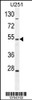 Western blot analysis in U251 cell line lysates (35ug/lane) .