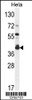 Western blot analysis in Hela cell line lysates (35ug/lane) .