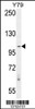 Western blot analysis in Y79 cell line lysates (35ug/lane) .