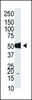 Western blot analysis of anti-mDnmt2 Pab in HL-60 cell lysate