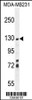 Western blot analysis in MDA-MB231 cell line lysates (35ug/lane) .