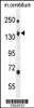 Western blot analysis in mouse cerebellum tissue lysates (35ug/lane) .