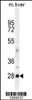 Western blot analysis in mouse liver tissue lysates (35ug/lane) .