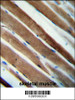 CCDC38 Antibody immunohistochemistry analysis in formalin fixed and paraffin embedded human skeletal muscle followed by peroxidase conjugation of the secondary antibody and DAB staining.