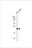 Western blot analysis of lysate from human brain tissue lysate, using CPLX3 Antibody at 1:1000 at each lane.