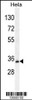 Western blot analysis in Hela cell line lysates (35ug/lane) .