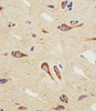 Immunohistochemical analysis of paraffin-embedded H. brain section using CB2 Antibody. Antibody was diluted at 1:25 dilution. A peroxidase-conjugated goat anti-rabbit IgG at 1:400 dilution was used as the secondary antibody, followed by DAB staining.