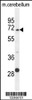 Western blot analysis in mouse cerebellum tissue lysates (35ug/lane) .